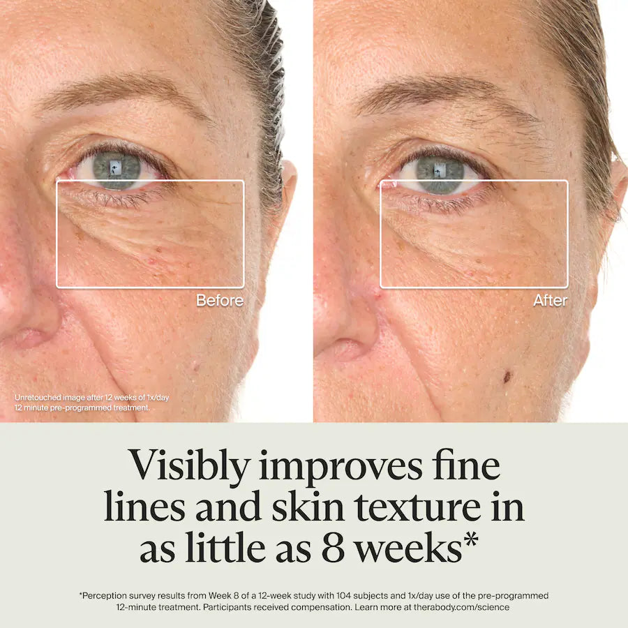 Therabody TheraFace Mask Glo - Clinically Proven LED Skincare, White